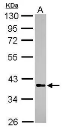 Anti-Rffl antibody [N2C3] used in Western Blot (WB). GTX117832