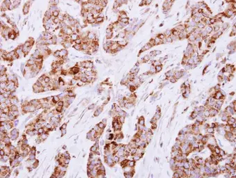 Anti-CESK1 antibody used in IHC (Paraffin sections) (IHC-P). GTX117858