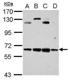 Anti-CESK1 antibody used in Western Blot (WB). GTX117858