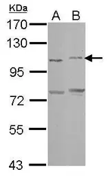 Anti-PCDHAC2 antibody [C1C2], Internal used in Western Blot (WB). GTX117859