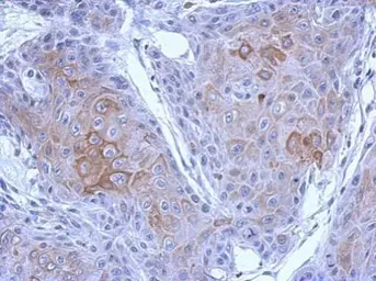 Anti-PCDH10 antibody [C2C3], C-term used in IHC (Paraffin sections) (IHC-P). GTX117862