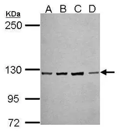 Anti-PCDH10 antibody [C2C3], C-term used in Western Blot (WB). GTX117862