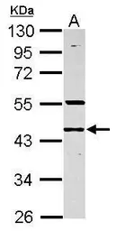 Anti-RNF133 antibody used in Western Blot (WB). GTX117869