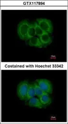 Anti-FGFR1OP2 antibody used in Immunocytochemistry/ Immunofluorescence (ICC/IF). GTX117894