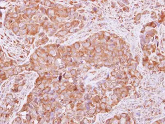 Anti-FGFR1OP2 antibody used in IHC (Paraffin sections) (IHC-P). GTX117894