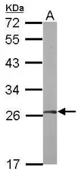 Anti-FGFR1OP2 antibody used in Western Blot (WB). GTX117894