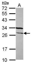 Anti-FGFR1OP2 antibody used in Western Blot (WB). GTX117894