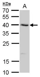 Anti-SerpinB8 antibody used in Western Blot (WB). GTX117950