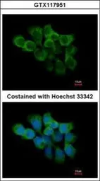 Anti-Cyclophilin F antibody [N1C3] used in Immunocytochemistry/ Immunofluorescence (ICC/IF). GTX117951