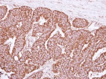 Anti-Cyclophilin F antibody [N1C3] used in IHC (Paraffin sections) (IHC-P). GTX117951