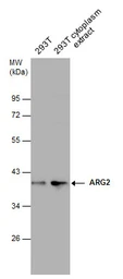 Anti-ARG2 antibody used in Western Blot (WB). GTX118048