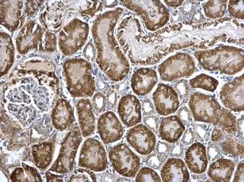 Anti-ARG2 antibody used in IHC (Paraffin sections) (IHC-P). GTX118048