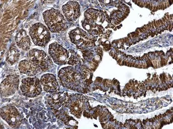 Anti-ARG2 antibody used in IHC (Paraffin sections) (IHC-P). GTX118048