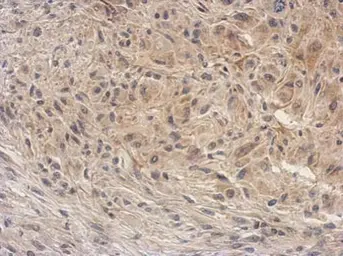 Anti-ARG2 antibody used in IHC (Paraffin sections) (IHC-P). GTX118048