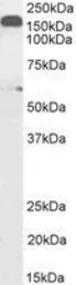 Anti-DCTN1 antibody, C-term used in Western Blot (WB). GTX11806