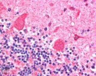 Anti-DCTN1 antibody, C-term used in IHC (Paraffin sections) (IHC-P). GTX11806