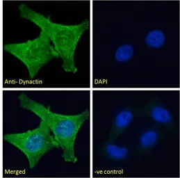 Anti-DCTN1 antibody, C-term used in Immunocytochemistry/ Immunofluorescence (ICC/IF). GTX11806
