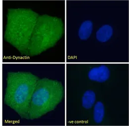 Anti-DCTN1 antibody, C-term used in Immunocytochemistry/ Immunofluorescence (ICC/IF). GTX11806