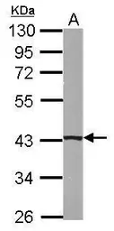 Anti-B4GALT5 antibody used in Western Blot (WB). GTX118066