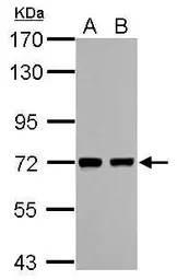 Anti-Caper antibody used in Western Blot (WB). GTX118112