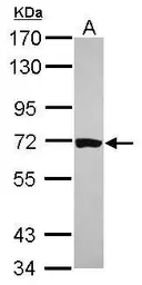 Anti-Caper antibody used in Western Blot (WB). GTX118112