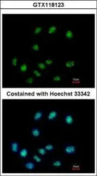 Anti-ELAC1 antibody used in Immunocytochemistry/ Immunofluorescence (ICC/IF). GTX118123