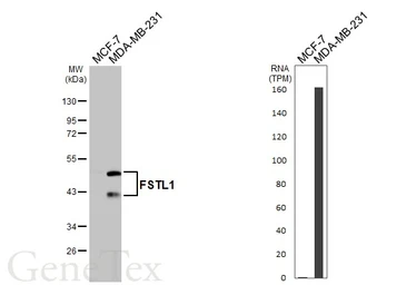 Anti-FSTL1 antibody [N1C3] used in Western Blot (WB). GTX118134