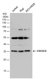 Anti-EXOSC8 antibody used in Western Blot (WB). GTX118146