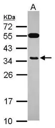 Anti-EXOSC8 antibody used in Western Blot (WB). GTX118146