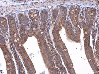 Anti-RAB39B antibody used in IHC (Paraffin sections) (IHC-P). GTX118261