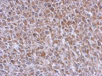 Anti-RAB39B antibody used in IHC (Paraffin sections) (IHC-P). GTX118261