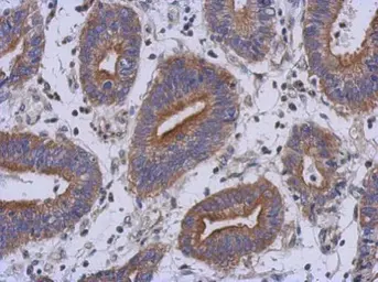 Anti-RAB39B antibody used in IHC (Paraffin sections) (IHC-P). GTX118261