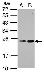 Anti-RAB39B antibody used in Western Blot (WB). GTX118261