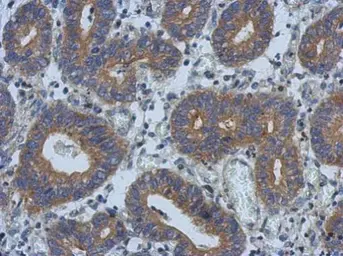 Anti-PSD antibody [C1C3] used in IHC (Paraffin sections) (IHC-P). GTX118290