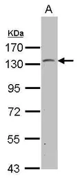 Anti-PSD antibody [C1C3] used in Western Blot (WB). GTX118290