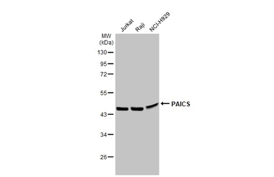 Anti-PAICS antibody used in Western Blot (WB). GTX118340