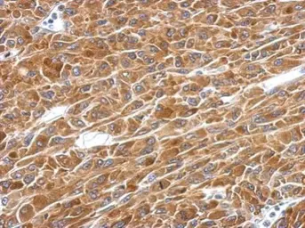 Anti-PAICS antibody used in IHC (Paraffin sections) (IHC-P). GTX118340