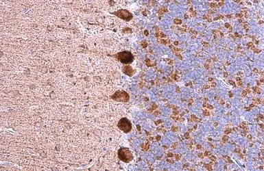 Anti-GABA A Receptor alpha 5 antibody [N2C2], Internal used in IHC (Paraffin sections) (IHC-P). GTX118345