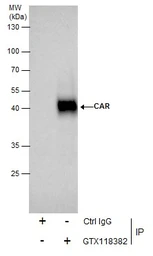 Anti-Coxsackie Adenovirus Receptor antibody used in Immunoprecipitation (IP). GTX118382