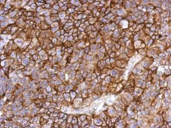 Anti-Coxsackie Adenovirus Receptor antibody used in IHC (Paraffin sections) (IHC-P). GTX118382