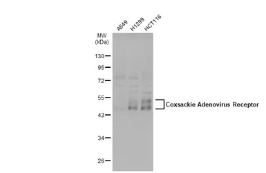 Anti-Coxsackie Adenovirus Receptor antibody used in Western Blot (WB). GTX118382