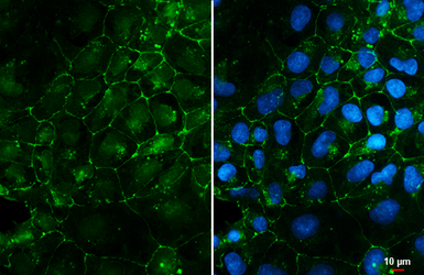 Anti-Coxsackie Adenovirus Receptor antibody used in Immunocytochemistry/ Immunofluorescence (ICC/IF). GTX118382