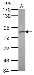 Anti-Calpain 13 antibody [C1C3] used in Western Blot (WB). GTX118394