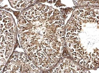 Anti-TMF1 antibody used in IHC (Paraffin sections) (IHC-P). GTX118431