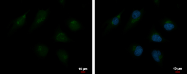 Anti-TMF1 antibody used in Immunocytochemistry/ Immunofluorescence (ICC/IF). GTX118432