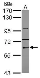 Anti-TKTL2 antibody [C1C3] used in Western Blot (WB). GTX118467