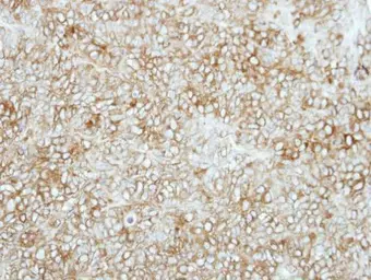 Anti-SEMA6C antibody [N1N2], N-term used in IHC (Paraffin sections) (IHC-P). GTX118489