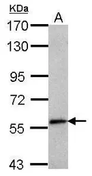 Anti-SEMA6C antibody [N1N2], N-term used in Western Blot (WB). GTX118489