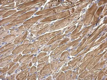 Anti-SNX25 antibody [N2C1], Internal used in IHC (Paraffin sections) (IHC-P). GTX118491