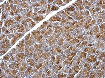 Anti-SNX25 antibody [N2C1], Internal used in IHC (Paraffin sections) (IHC-P). GTX118491